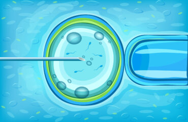 Vitro