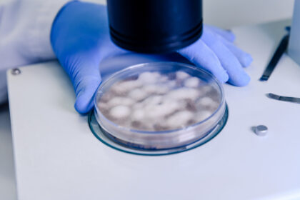 trabajador-laboratorio-examinando-sustancia-placa-petri-mientras-realiza-investigacion-coronavirus esperma